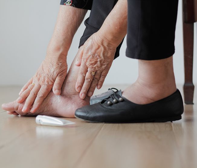 elderly woman putting lotion on swollen feet